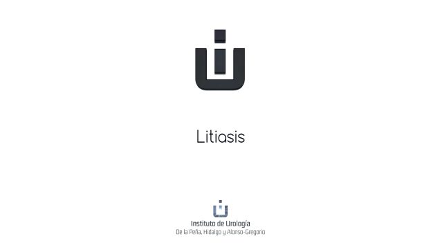 DR ALONSO 03 – LITIASIS – LARGO