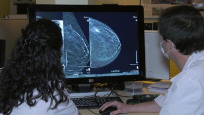 Genetica en el cancer de mama – Excelencia Medica TV – Unidad de la Mujer
