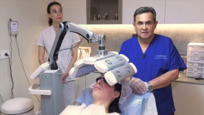 Microneedling Facial – Clinica Gabriel Serrano
