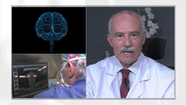 NEUROLOGIA – Cirugía de la epilepsia – Excelencia Medica TV
