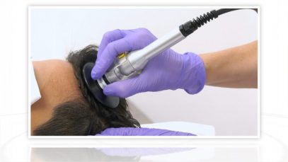 DRA CARMEN – Tratamiento Revital Hair – Excelencia Medica TV