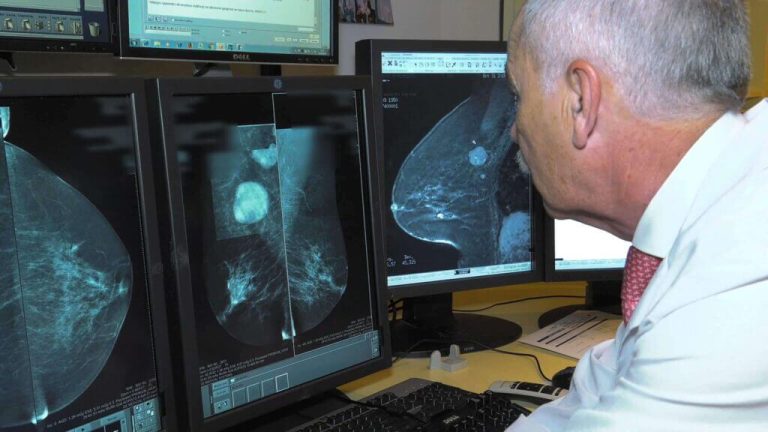 Prevención y Diagnóstico Precoz de Patología Mamaria