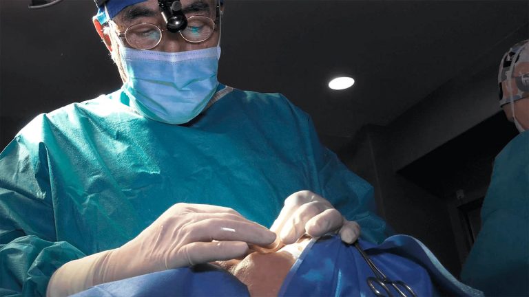 Rinoplastia