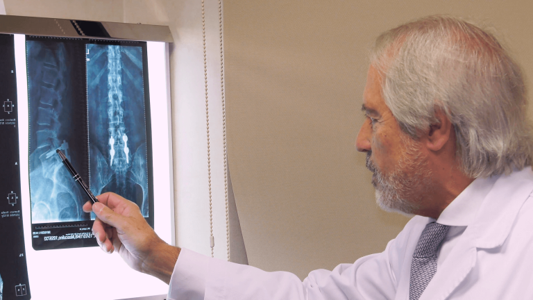 Tornillos Transpediculares