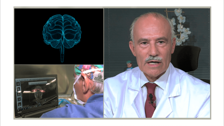 Neuroimagen en Epilepsia