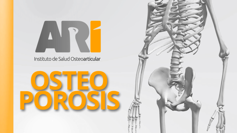 Osteoporosis