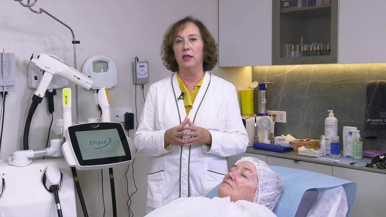 Tratamiento Facial con IPL