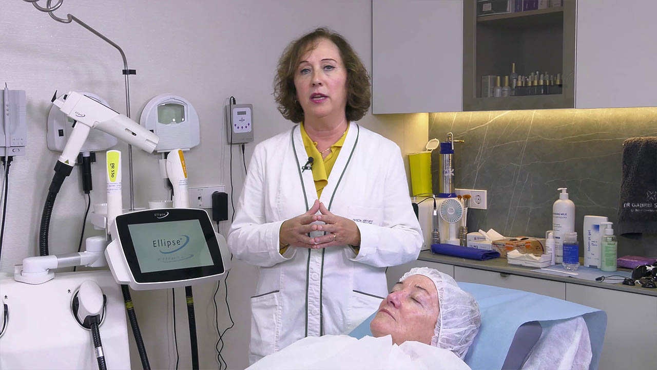 Tratamiento Facial con IPL